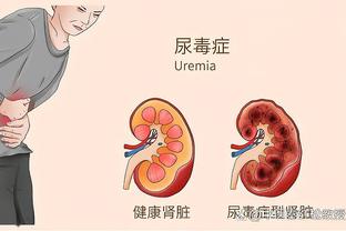 迪马：那不勒斯接近签佩雷斯，1600万转会费+200万奖金+租借球员